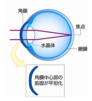 装用後